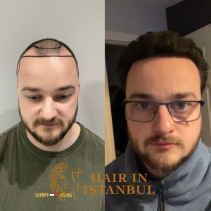 WhatsApp Image 2025-11-24 at 21.12.45 (2)