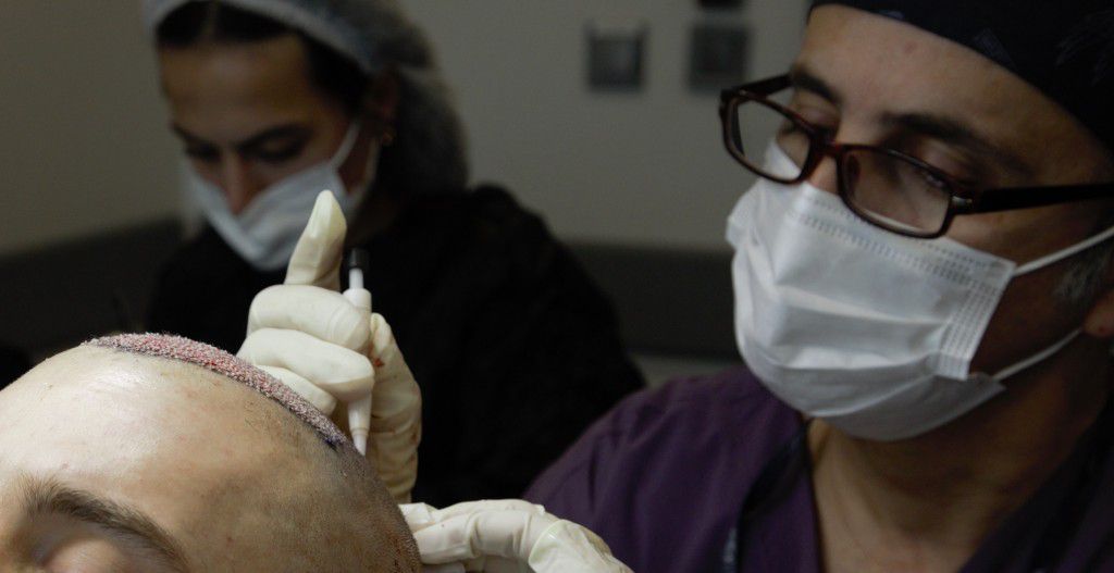 clinica de implante capilar procedimiento especializado